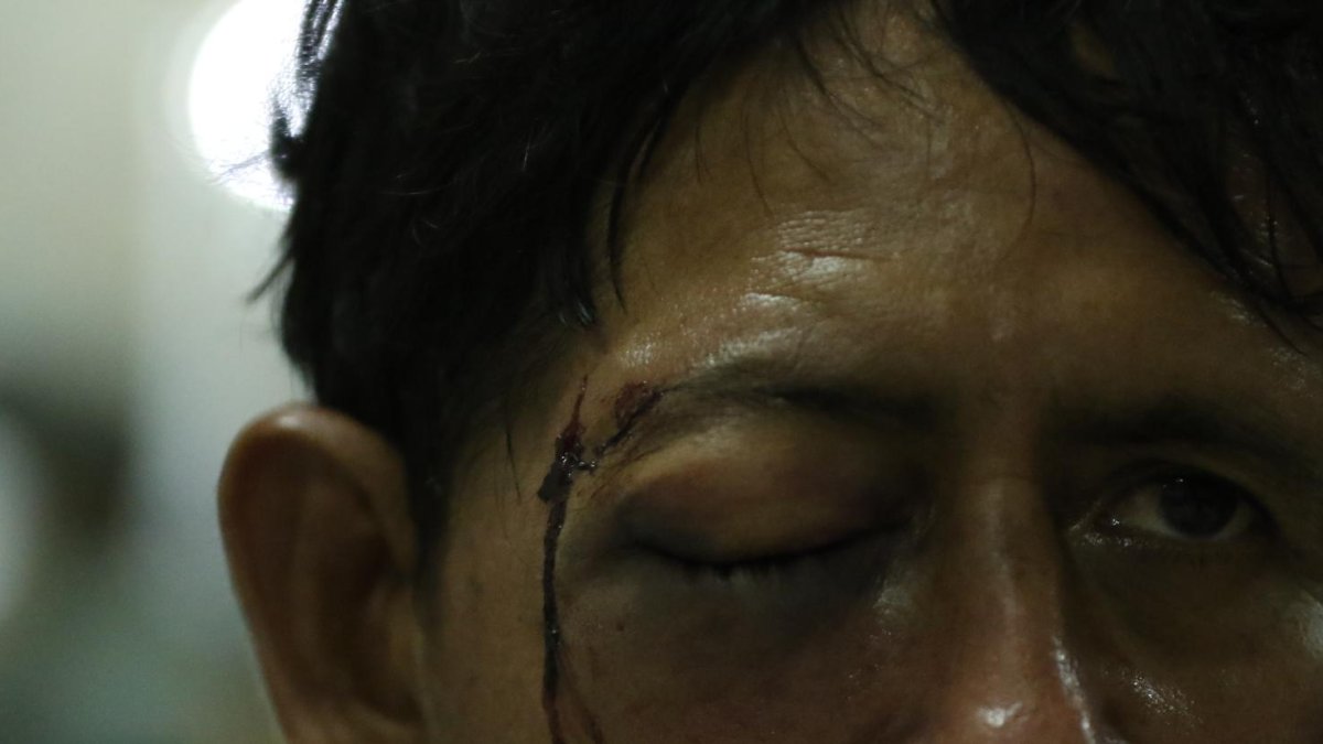 Carlos esperaba el turno de reconocimiento médico para que le den una boleta de auxilio.