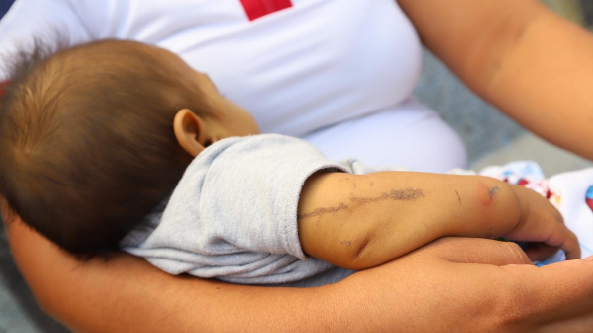 Según los médicos, el bebé habría nacido sin vesícula provocándole problemas al hígado.