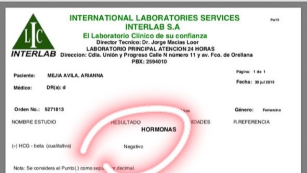 Prueba de embarazo que salió negativo