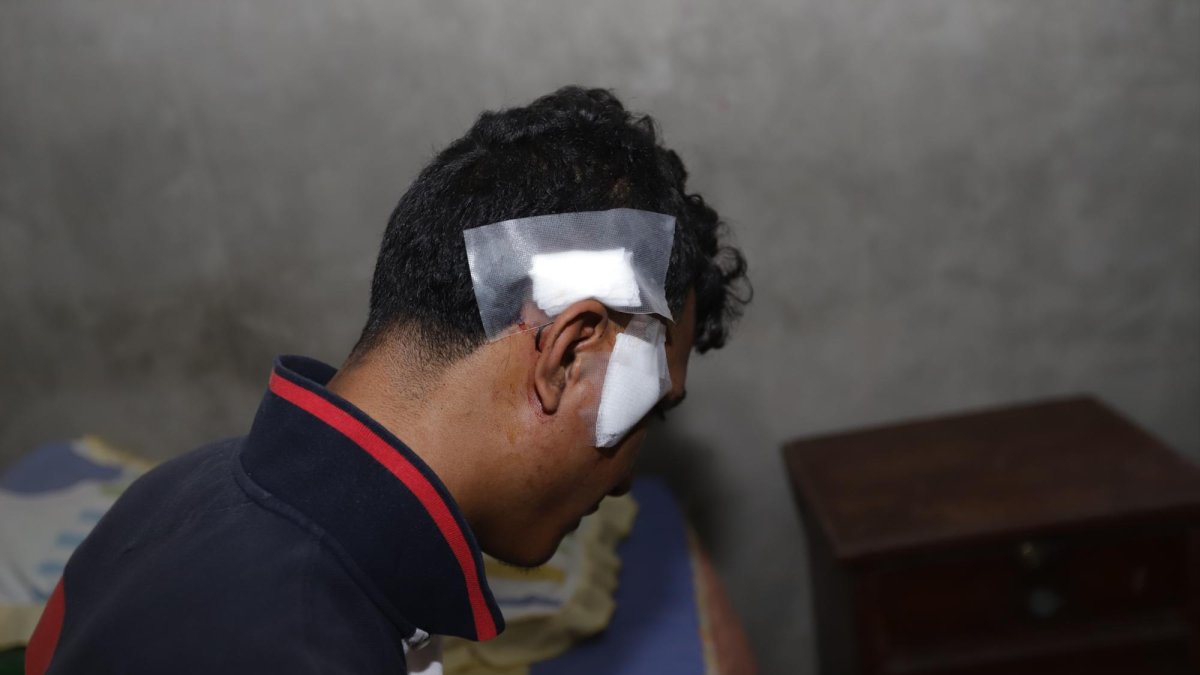 El joven herido de bala se recupera en su casa.