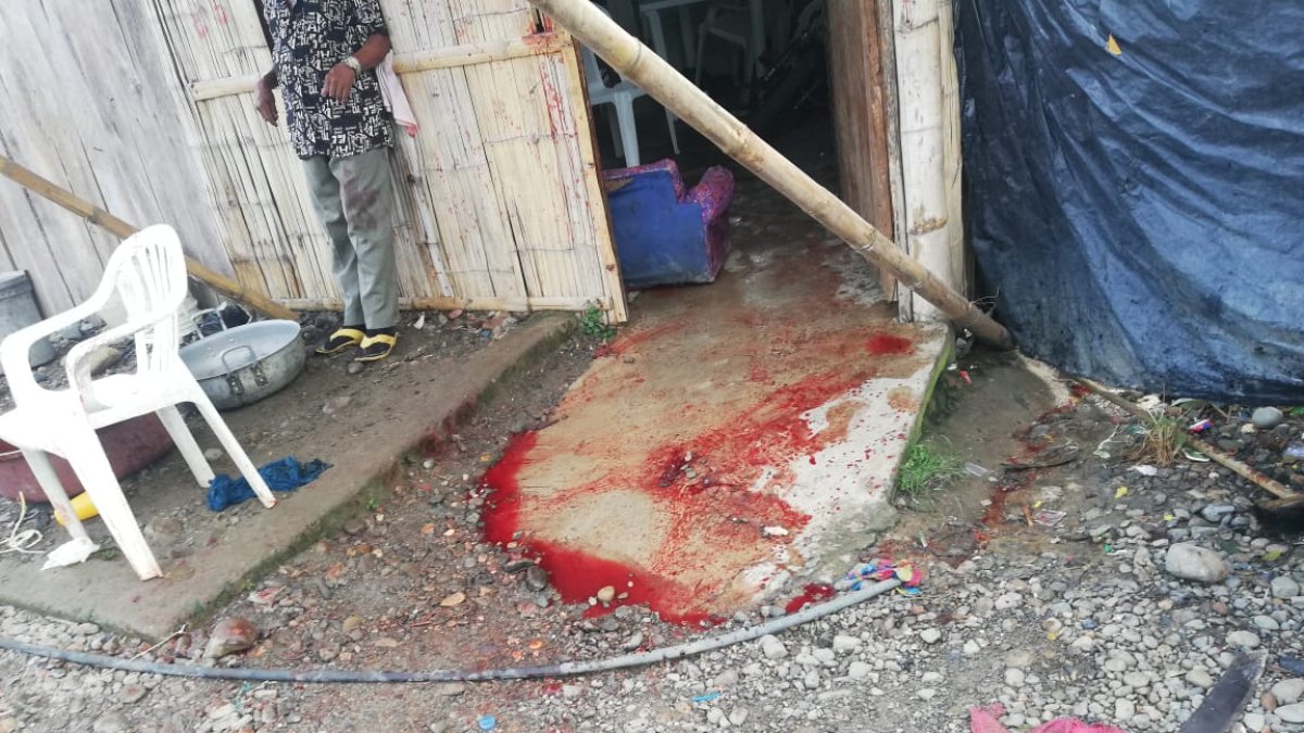 Tras una discusión, un hombre atacó con un machete a su exconviviente la mañana del lunes 11 de marzo.