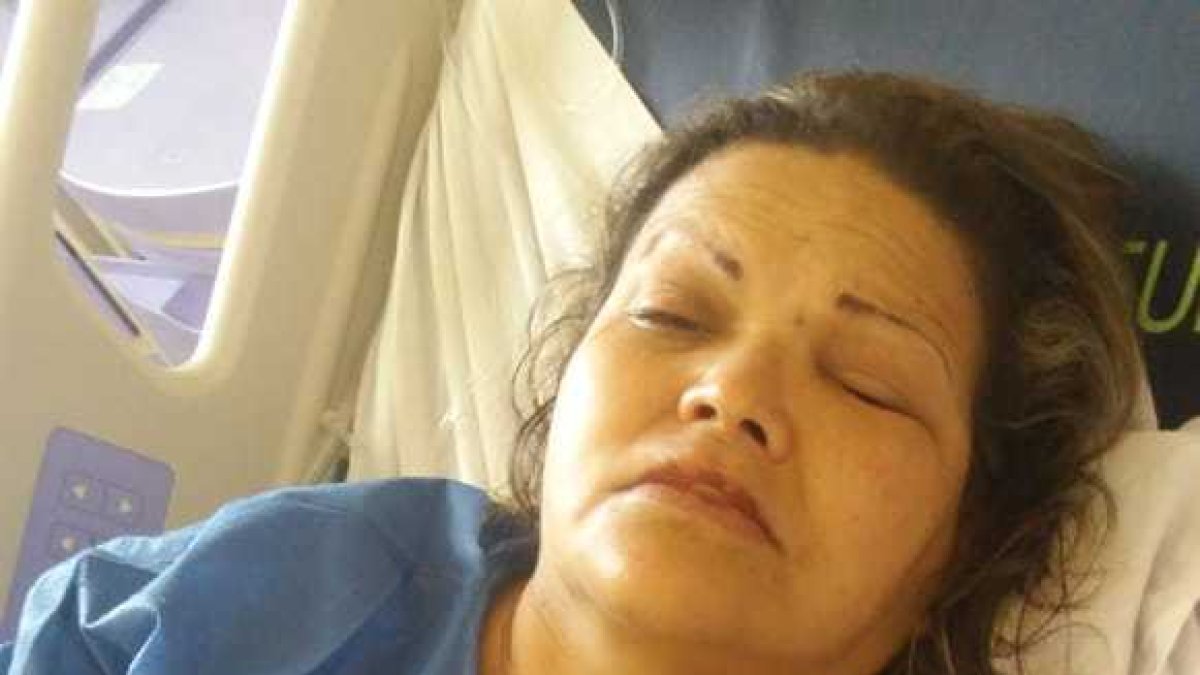 Carmen Herrera fue víctima de un ataque con ácido. Sucedió en la casa de su clienta.