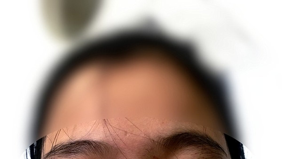 Fue diagnosticada con hematidrosis, también sufre fuertes dolores de cabeza