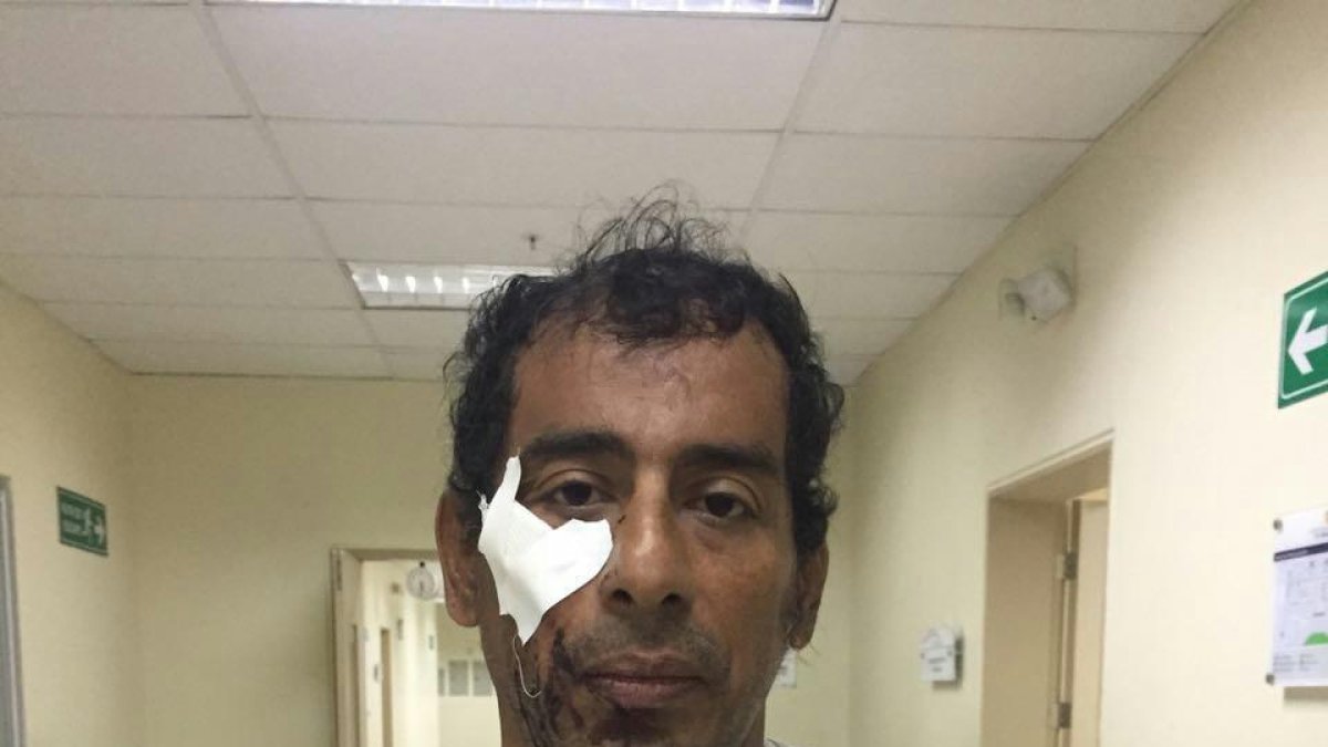 El sospechoso Luis Velasco Caballero, de 47 años, fue entregado a la Policía, presenta un golpe en el rostro.