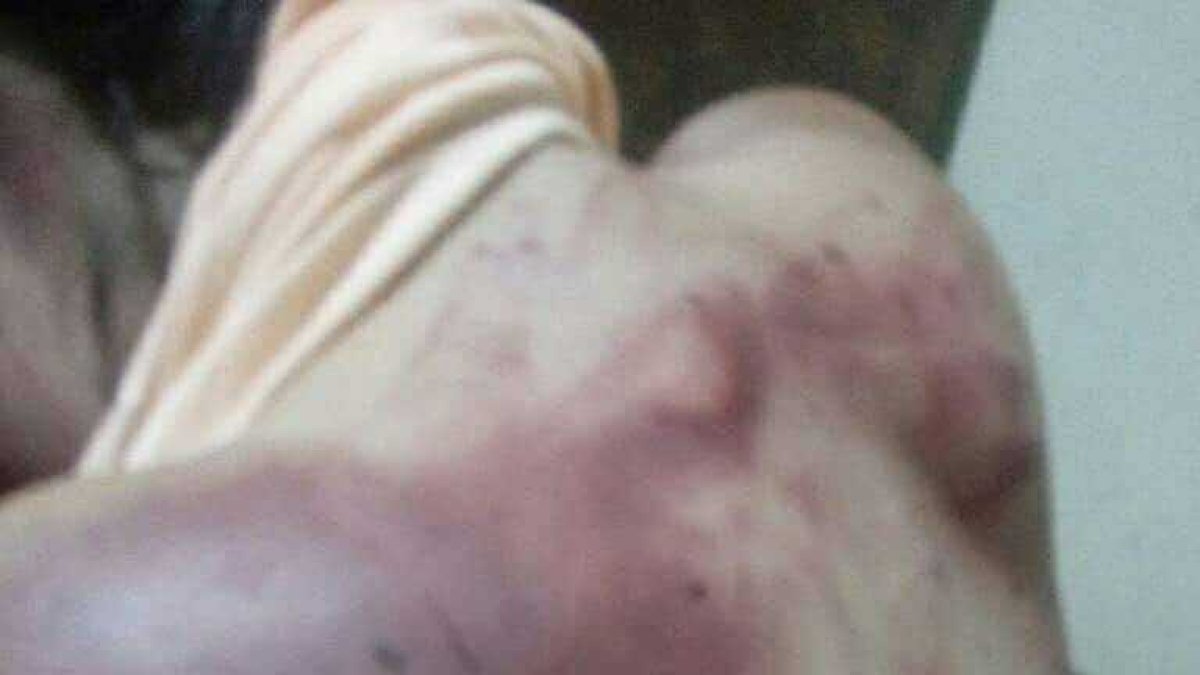 La mujer presenta golpes en la espalda, rostro y cabeza. Además heridas de cuchillo.