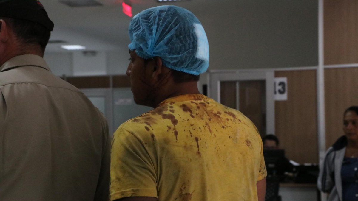 El sospechoso de 29 años, Jorge Martínez, fue agredido por el presunto abuso sexual en contra de su hijastra. Presenta tres cortes en la cabeza.