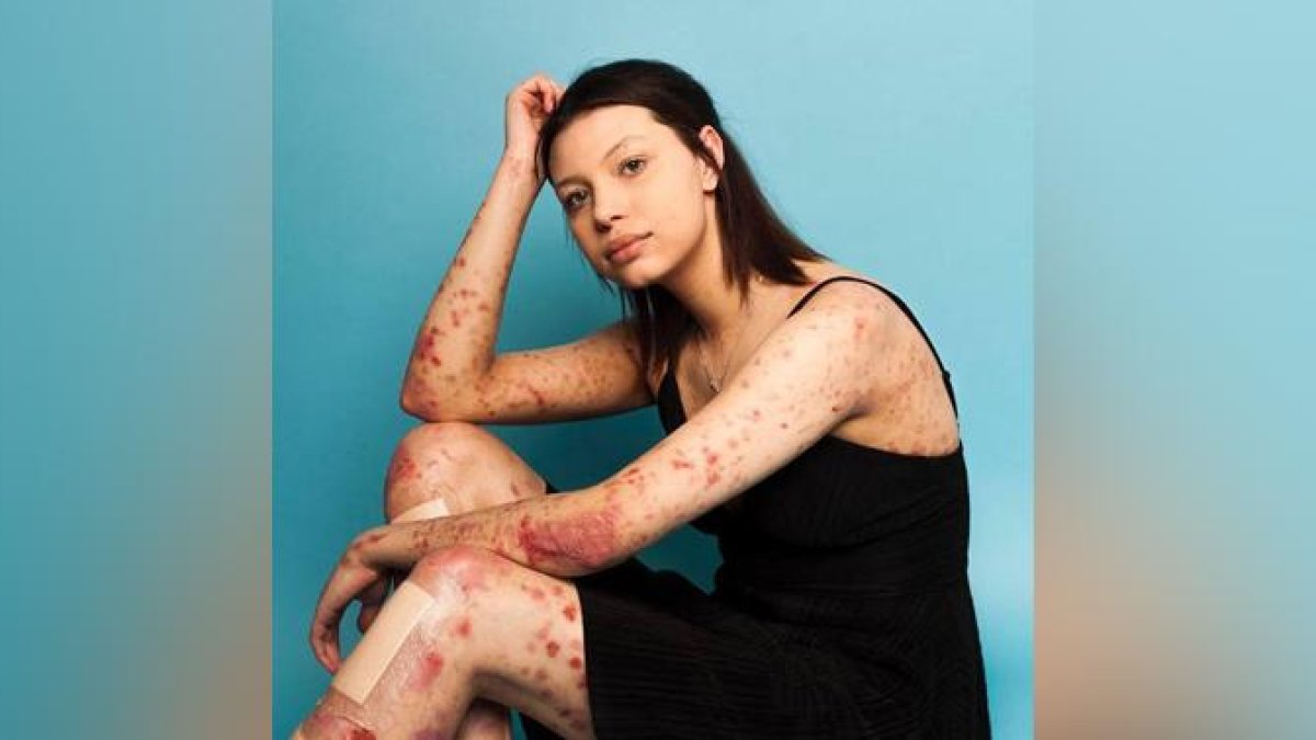 Una de las modelos de Sophie Mayanne muestra su piel de mariposa.