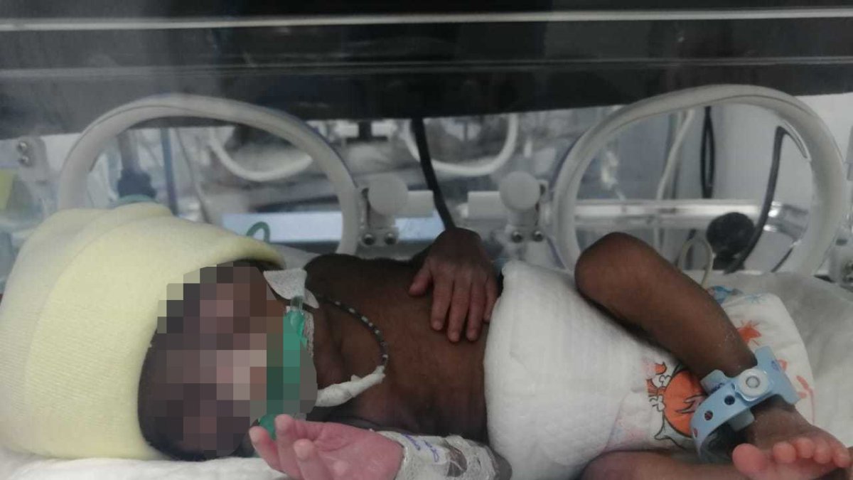 Estuvo 43 días en la Unidad de Cuidados Intensivos y nació con un peso de 1.200 gramos.