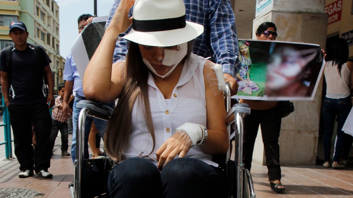 En 2013, en el cantón Simón Bolívar, que ahora dirige, Mafer Vargas fue atacada.