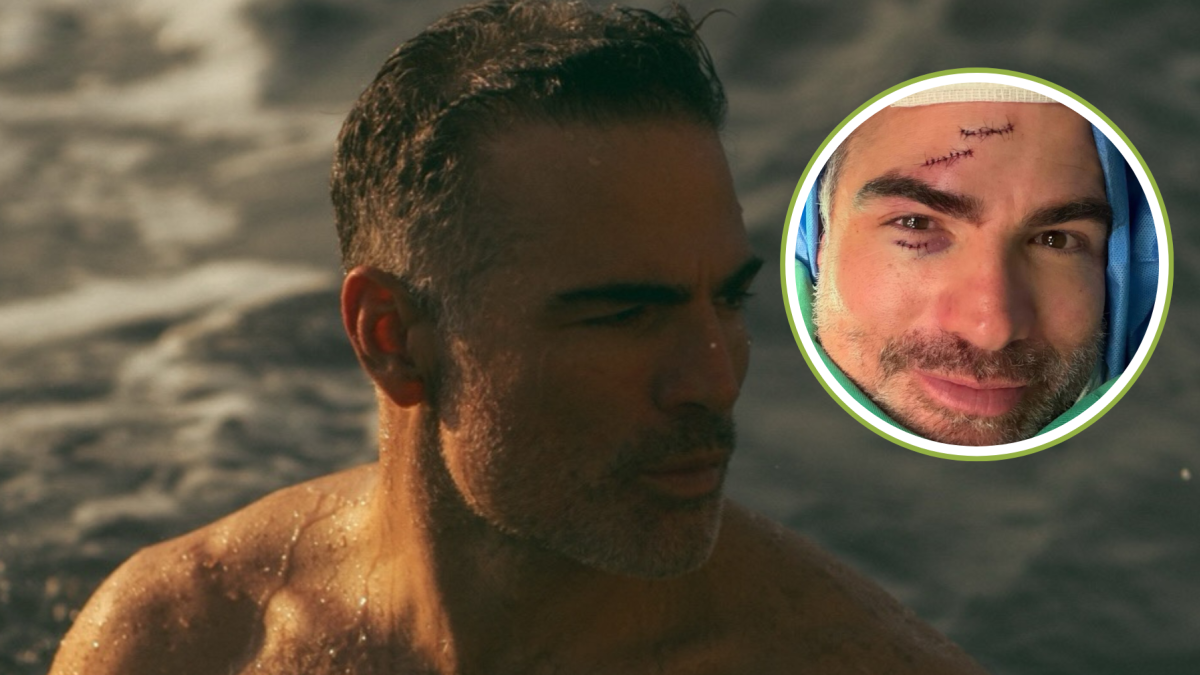 Roberto Manrique fue operado de emergencia en el rostro tras un accidente