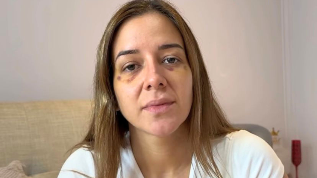 Scarlett Córdova denuncia agresión de quien fuera su pareja sentimental y relata duro momento