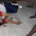 La víctima recibió un tiro en la cabeza y otro en la pierna derecha.