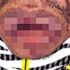 Ítalo Cruz Matías perdió parte de su lengua. También presenta heridas en sus manos.