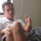 Marco Caizapanta sobrevivió al accidente en la vía a Samborondón.