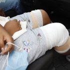 Los médicos suturaron las heridas provocadas por las mordeduras de la mascota.