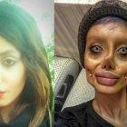 La mujer iraní antes y después de las cirugías plásticas que le cambiaron el rostro de manera profunda.