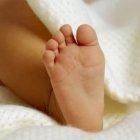 El bebé nació con una cola que luego fue extirpada.