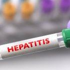 La hepatitis infantil grave tiene en alerta a muchos países, entre ellos Ecuador.