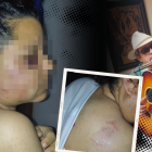 Familiar del artista se recupera en su hogar.