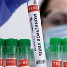 Las vacunas contra la viruela del simio