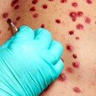 Según Salud, el menor contrajo el virus en la provincia de Los Ríos por "contacto estrecho" durante sus vacaciones.