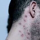 Referencial. Durante el feriado se confirmaron los dos últimos en Azuay y Cañar.