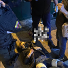 La agresión ocurrió durante un asalto. El tipo huyó con la cartera de la víctima.