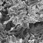 Unas moléculas protectoras presentes en el moco podrían prevenir el cólera