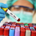 Un compuesto en el semen inhibe una variante del VIH