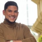 Emilio Pinargote se hizo injerto de cabello en la barba.