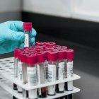 Envases de muestras de sangre para su analisis