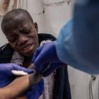 Hombre infectado con viruela del simio es atendido por personal de salud en el Congo.