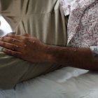 Un paciente es atendido tras ser diagnosticado con mpox, el 24 de agosto de 2022.