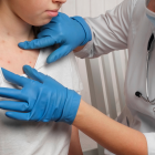 Las erupciones en la piel son el principal síntoma de viruela del mono.