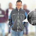 Mediante una radiografía se comprobó que el sospechoso tenía la cadena en su intestino.