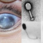 Un virus marino detectado en humanos en China enciende las alarmas tras causar pérdida de visión en los primeros casos vinculados al consumo de mariscos