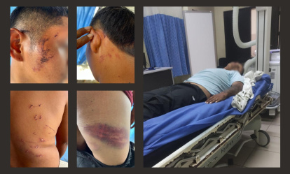 El joven que se identifica como sobreviviente registra varias lesiones en el cuerpo.