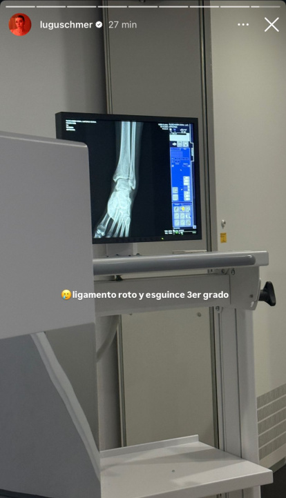 Luciana Guschmer tiene su ligamento roto y esguince de tercer grado.